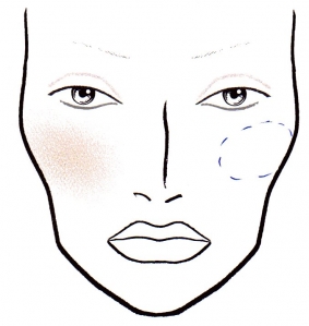 desenho de rosto feminino mostrando bioplastia de maca do rosto